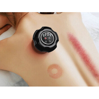 Ηλεκτρική Κινέζικη Βεντούζα Μασάζ με Θέρμανση και 12 Επίπεδα Αναρρόφησης 5907451364635 Verk Group